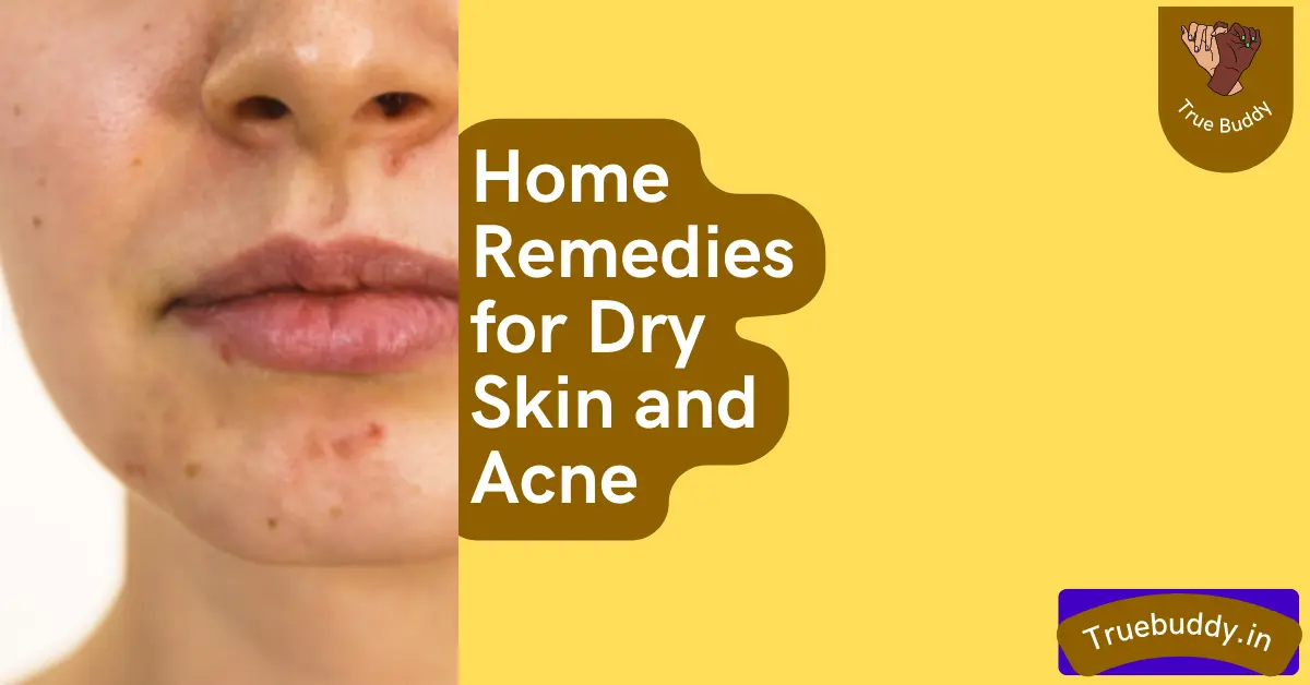Home Remedies For Dry Skin And Acne Dry Skin Causes True Buddy